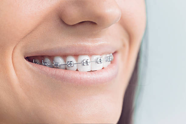 Best Traditional Braces  in West Clarkston Highland, WA